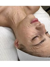 リン(琳 rin)/ゾンビマスク