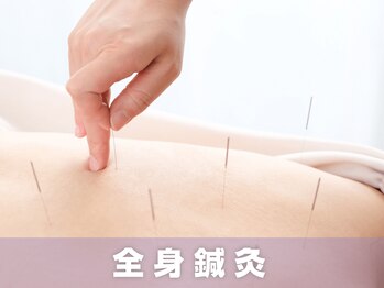 サボテン接骨院 はりきゅう院 北浦和浦高通り院(SABO-TEN接骨院 はりきゅう院)/清潔なステンレス鍼を使用☆