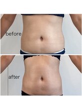 サロン ド メタセコイア(salon de Metasequoia)/30代女性