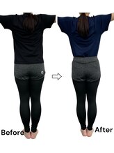 ブライトプラス(BRIGHT+)/ダイエットコース