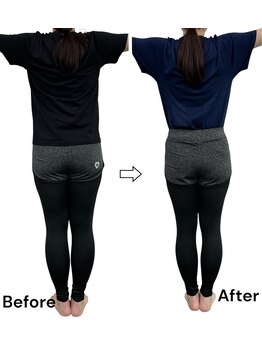 ブライトプラス(BRIGHT+)/ダイエットコース