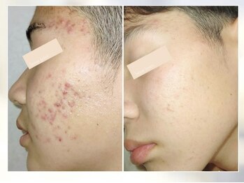 ゾーンビューティーハウス 松戸店(ZONE BEAUTY HOUSE)/美容男子 必見！