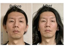 ショウフェイスデザイン(Sho Face Design)/《小顔矯正》ビフォーアフター