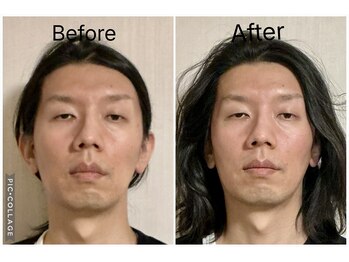 ショウフェイスデザイン(Sho Face Design)/《小顔矯正》ビフォーアフター