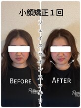 リバイブ 自由が丘店(REVIVE)/小顔矯正+ドライヘッドスパ1回