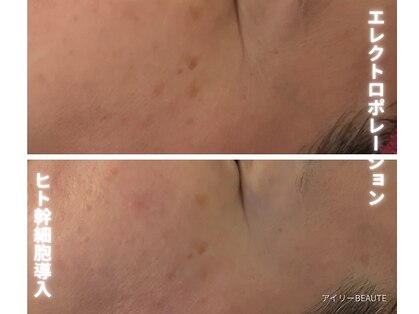 アイリーボーテ 東大阪(アイリーBEAUTE)の写真