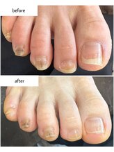 ケアプラス(care plus)/フットネイルケア