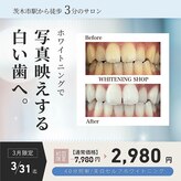 ホワイトニングショップ 茨木店