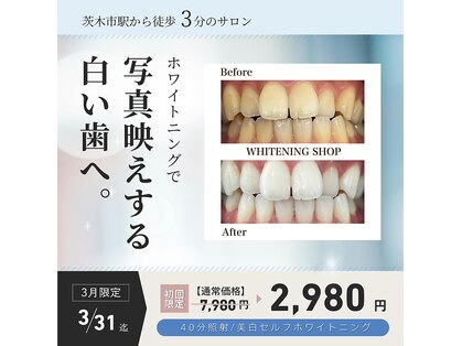 ホワイトニングショップ 茨木店の写真