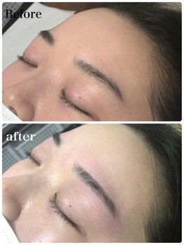 キュア(Cure)/美眉 Waxデザインニング脱毛