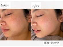 ピーロ ルレ(salon Piilo Rule)/オールハンドの一回施術後