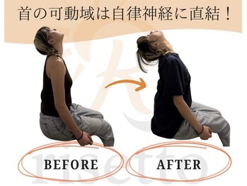 リセット鍼灸院(Risetto鍼灸院)/首の可動域は自律神経に直結!
