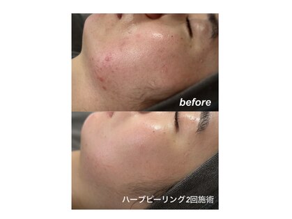 エードット スパ アンド ハーブ(a.spa & herb)の写真