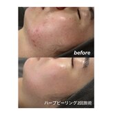 エードット スパ アンド ハーブ(a.spa & herb)