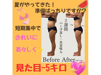 ヨサパーク ネモフィラ(YOSA PARK)の写真
