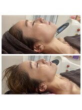 ルーク(Luke)/プラズマシャワー