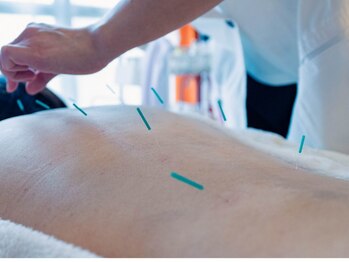 ミリグラム(mg)/３．【体質別に合わせた鍼施術】