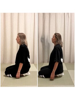 ツリー鍼灸整骨院 吹田店(TREE鍼灸整骨院)/腰痛には整体を！