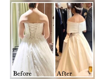 蒼(so)の写真/花嫁様の【最後の砦】に！美しいドレス姿は[安定した骨格]が鍵。誰もが羨む小顔と華奢な体&背中&鎖骨肩甲骨