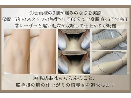 ［脱毛専門・肌育サロン］LULU.tokyo池袋2nd店の写真