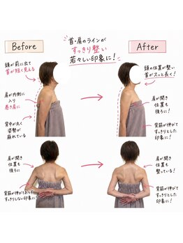 ねむねこ/首と肩が整い、若々しい印象に