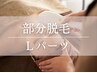 【女性限定】都度☆warm式肌質改善脱毛"Lパーツ"1回 ¥10,000