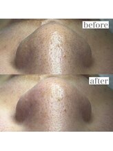 ライカブルー(RaicA BluE)/施術写真　before-after