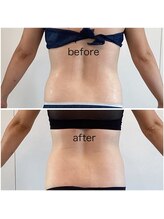 サロン ド メタセコイア(salon de Metasequoia)/30代女性