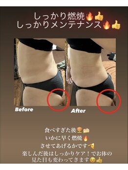 アローナ(ARONA)/本気の痩身ならARONA！