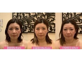 アジール 新潟市(agir)/Before/After画像