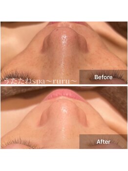 ルル 西大寺店(ruru)/マーメイドセルトリートメント