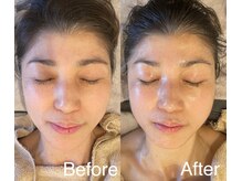 エイミー(Amy)/コルギ&韓国肌管理でツヤ&若見え