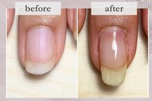 【深爪矯正・自爪育成専門サロン】Nalu.nailsalon