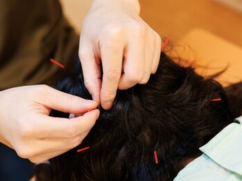 まるはりきゅう治療院の写真/痛み・深部のコリ・自律神経を整える刺激の少ない鍼灸でリセット◎不調の原因を追究し、根本から改善します