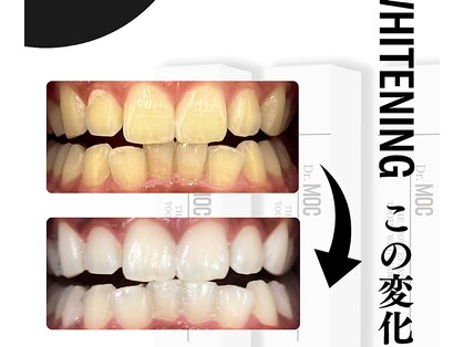 ウィンクルム(Vinculum)の写真