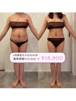 ニコ センター南店(nico)の写真/【結果主義＝本気痩身】“セルライトゼロ” で、頑固な脂肪や凹凸セルライトに激アプローチ！！