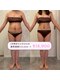 ニコ センター南店(nico)の写真/【結果主義＝本気痩身】“セルライトゼロ” で、頑固な脂肪や凹凸セルライトに激アプローチ！！
