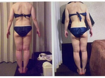 パーフェクトボディプレミアム 大阪梅田店(PERFECT BODY PREMIUM)/お客様　ビフォーアフター（5）