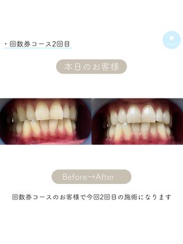 アイブロウ33/ホワイトニング