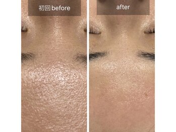 シファ(SHIFA)/お肌のゴアつきざらつきも綺麗に