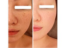 ジーニー(Genie)/前の自分には戻れない