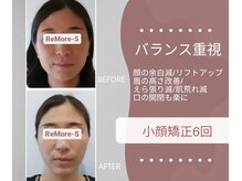 りもあず(ReMore-S)