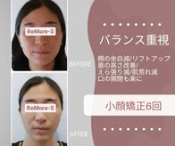 りもあず(ReMore-S)