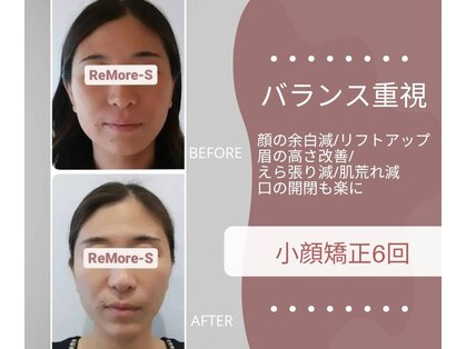 りもあず(ReMore-S)の写真