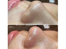 ピエル 北千住店(PIEL)/満員御礼