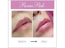 スターティス(STATICE)の雰囲気(最新技術ローマピンク導入♪黒ずみ除去!唇/ニップル/VIO/脇膝肘)