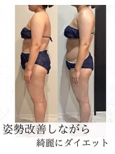 エスエー(SA)/3ヶ月あれば変わる