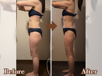 エクラ(eclat)/セルゼロ痩身変化