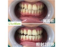 ルブラン 奈良店(Le Blanc)/歯も歯茎も綺麗になる