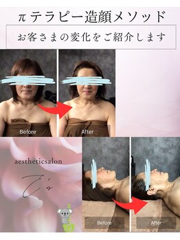 えにし整骨院 整体院の写真/顔だけじゃない。本来の美しさは全身から。小顔×自律神経ケアのπテラピーで、毎日鏡を見るのが楽しみに♪